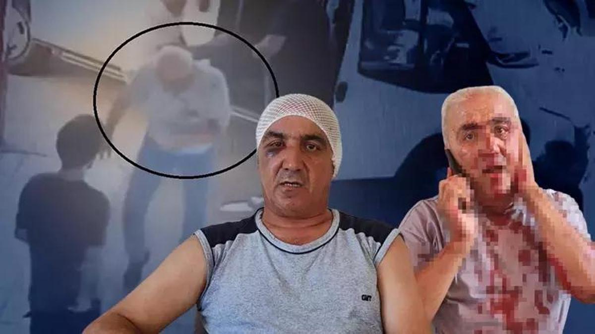 Yolcu şoförü 9 yerinden ısırdı, kulağını kopardı! o anlar saniye saniye kayıtlarda