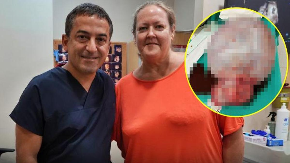 Karnından tam 6 kilo çıktı! Kasık ağrısıyla gitti, doktorlar bile inanamadı