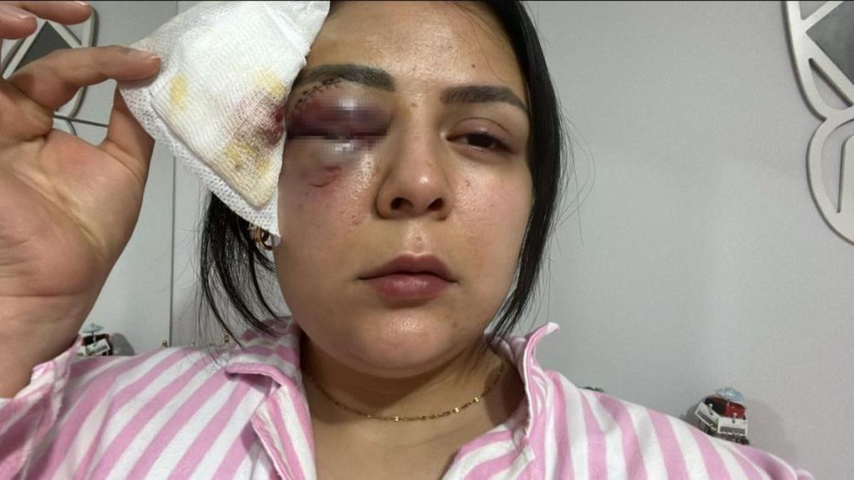 Yolda yürürken genç kıza yumruk attı! Korku dolu anları anlatırken saldırgan tutuklandı