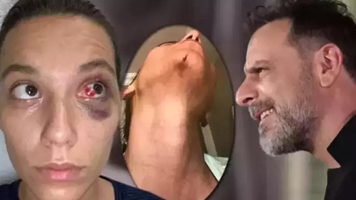 Eski sevgilisi Deniz Bulutsuz'u darp ettiği iddiasıyla yargılanan Ozan Güven'e 11 yıl hapsi cezası istemi
