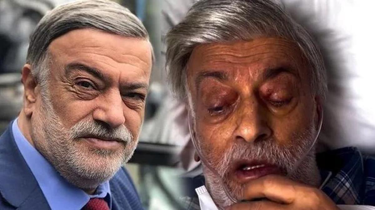 74 yaşındaki 'Kahtalı Mıçe’den acı haber geldi! Kanserle mücadele ediyordu