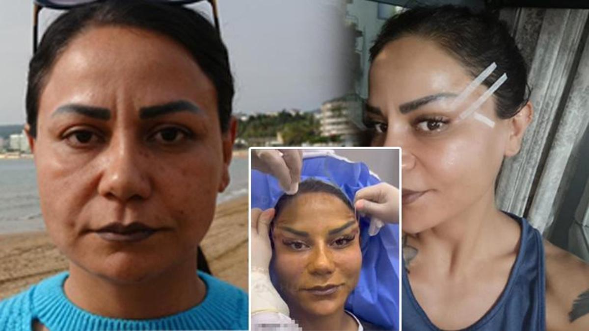 Antalya'da estetik kabusu! 220 bin TL'ye bıçak altına yattı, hayatı alt üst oldu