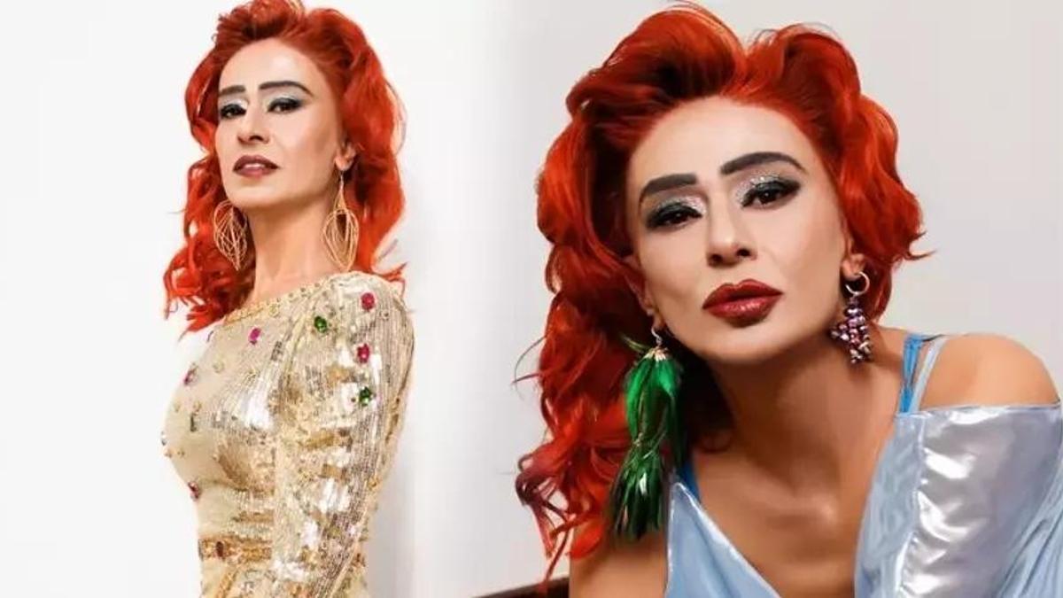 Saç boyasından yüzü yanmıştı! Yıldız Tilbe yeni imajını paylaştı!