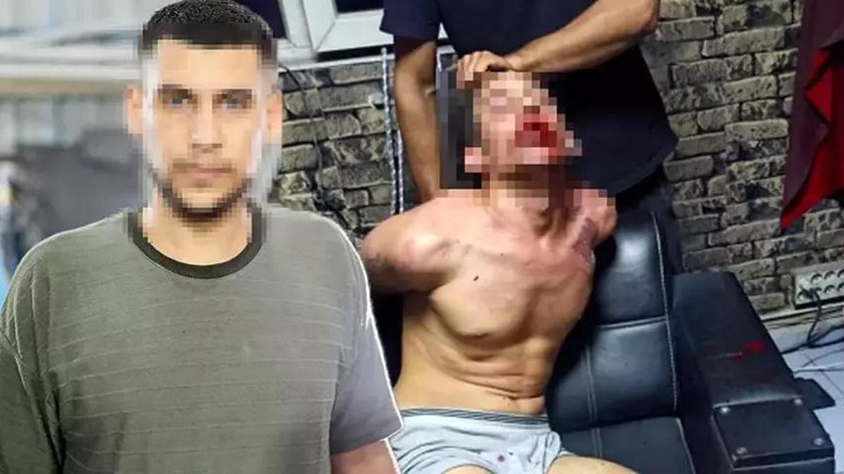 Dişleri kırılıp, hamam böceği yedirildi! 3 günlük işkencede şok rapor