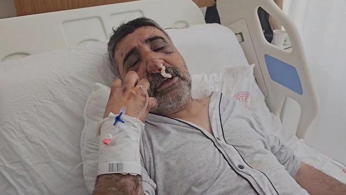 İngiliz boksör tarafından darbedilen taksi şoförü konuştu: Isırmaya öpmeye başladı!