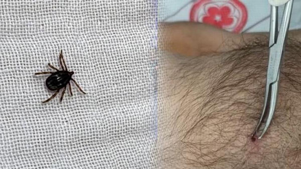 Sivas, Tokat ve Yozgat’ta yoğun olarak görülüyor! Bu belirtileri taşıyanlar dikkat