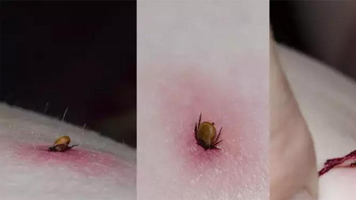 Keneler can almaya devam ediyor! Nereden ısırdığı çok önemli! Uzmanlar Karadeniz ve İç Anadolu’ya dikkat çekiyor