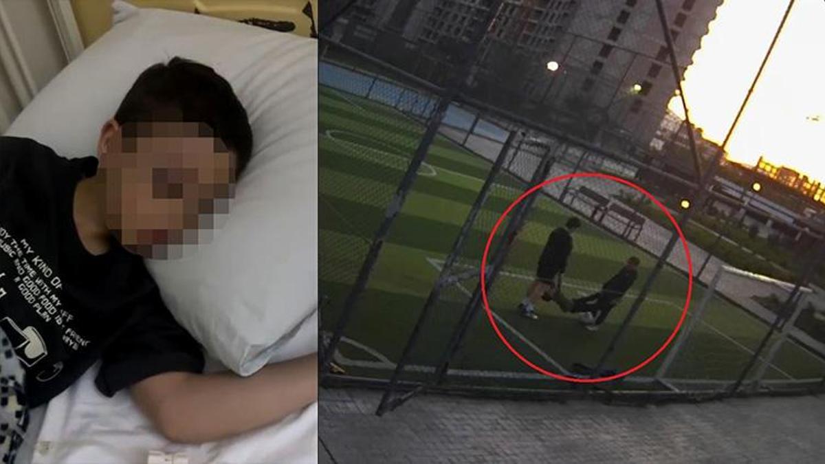 'Ergenler' bir çocuğun daha hayatını kararttı! Samsun'da ayaklarından ve kollarından tutulup fırlatılan çocuk beyin kanaması geçirdi