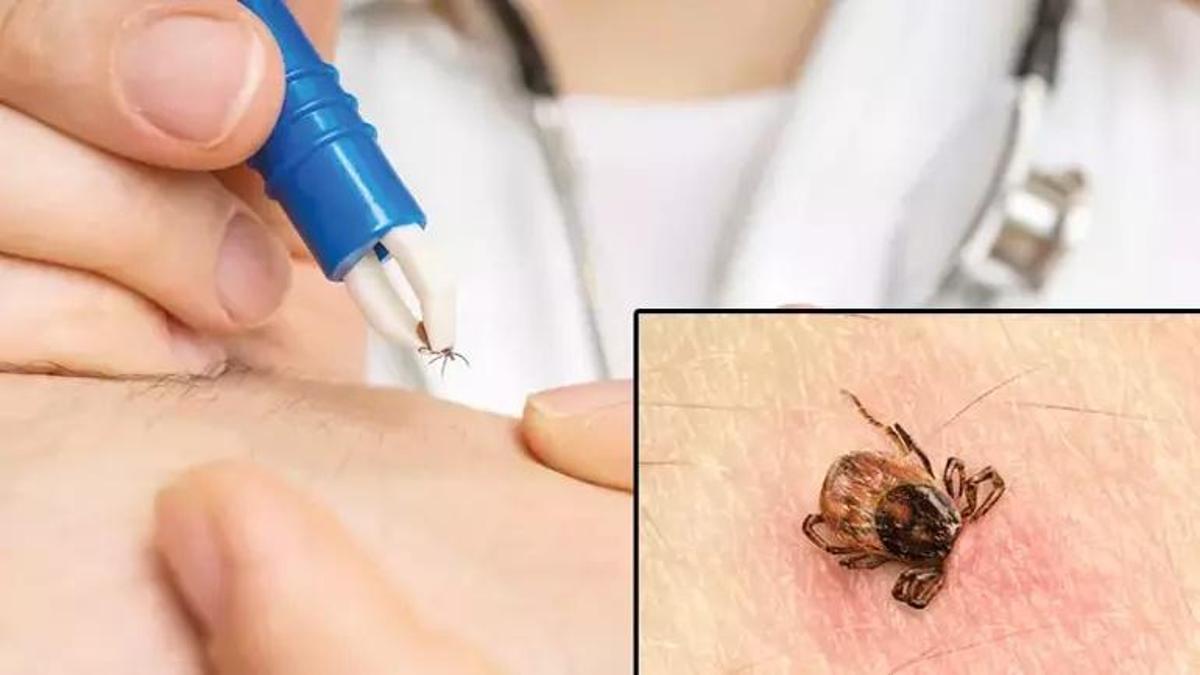 Türkiye'de 7 şehirde görüldü! Kene hakkında doğru bilinen 10 yanlış