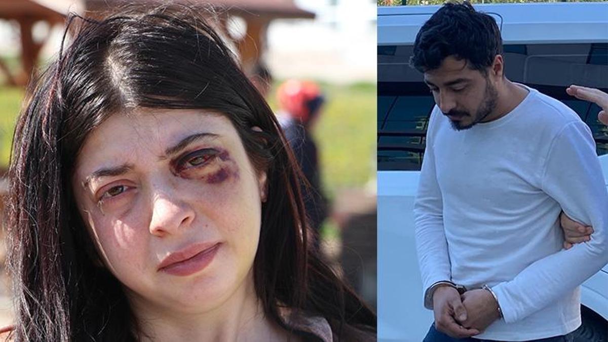 Samsun'da Damla Korkmaz'ı dövüp taciz eden şüpheli ilk duruşmada serbest bırakıldı!
