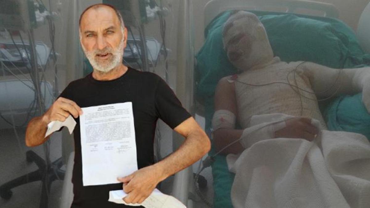 Adana'da gerçek kamerada ortaya çıktı: Amcası oğlumu benzin döküp yaktı