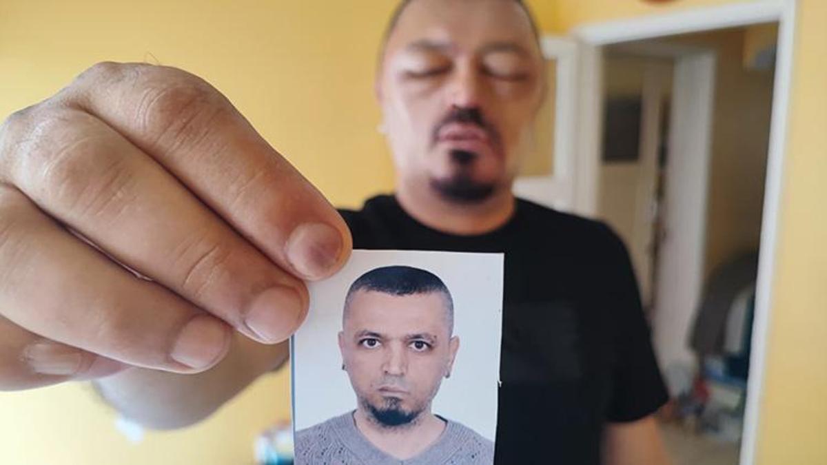 Berber tavsiyesi hayatını kabusa çevirdi! İnternetten satın aldı, yüzü tanınmayacak hale geldi