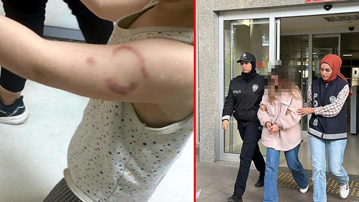 Edirne'de öğrencisinin kolunu ısıran öğretmen tutuklandı!