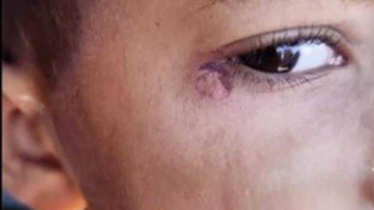 Öğrencinin yüzünde sigara söndüren temizlikçi tutuklandı