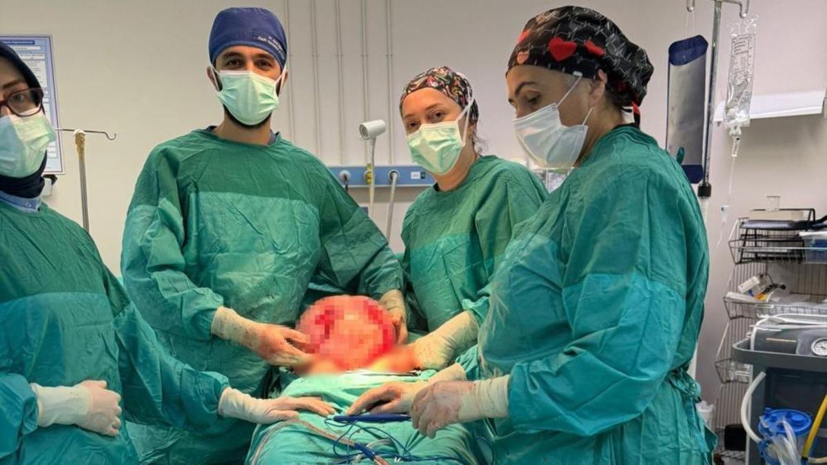 2 ayda karnı büyüdü! Doktorlar sonuca şaşırdı: Karpuz büyüklüğünde çıktı