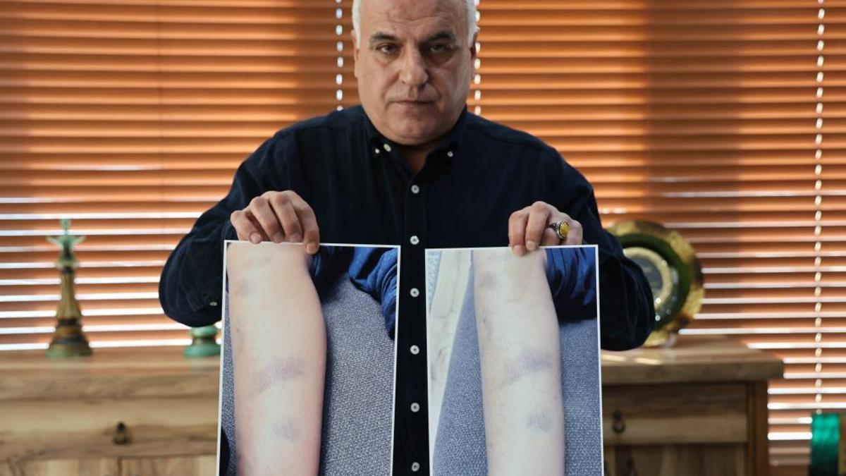 Diyarbakır'da özel okulda 8 yaşındaki çocuğun darbedildiği iddiası