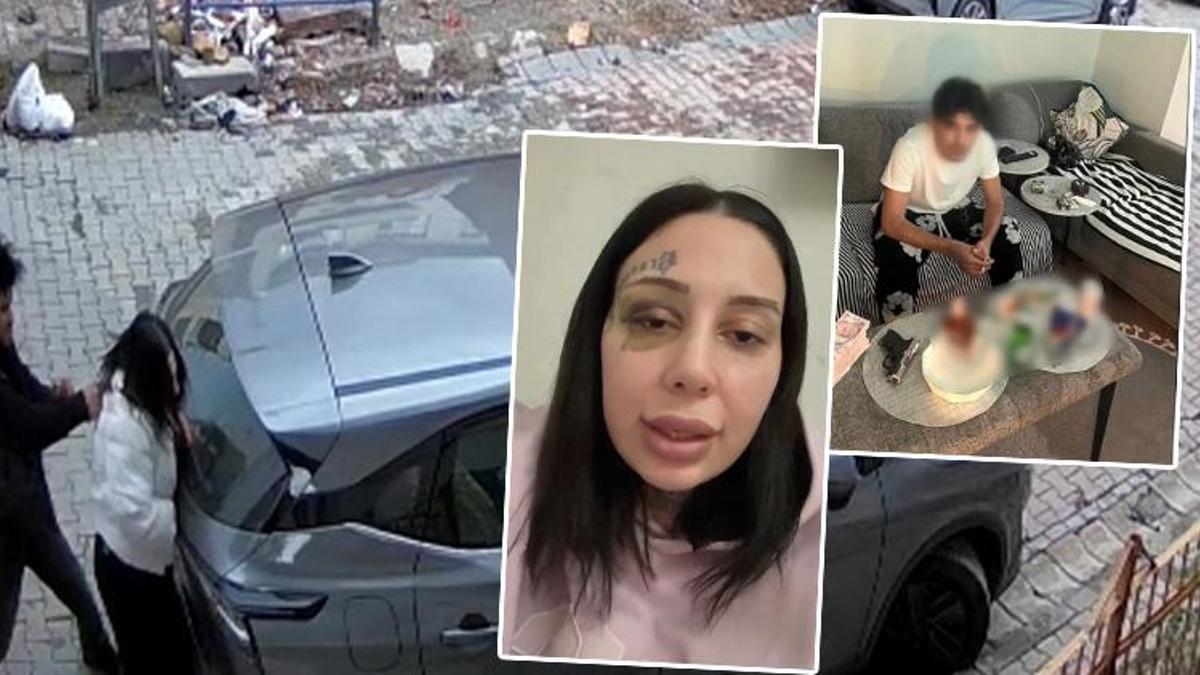 Boşanma aşamasındaki eşine şiddet uygulayan şahsın ifadesi ortaya çıktı: Burun estetiği masrafını karşıladım boşanmak istedi