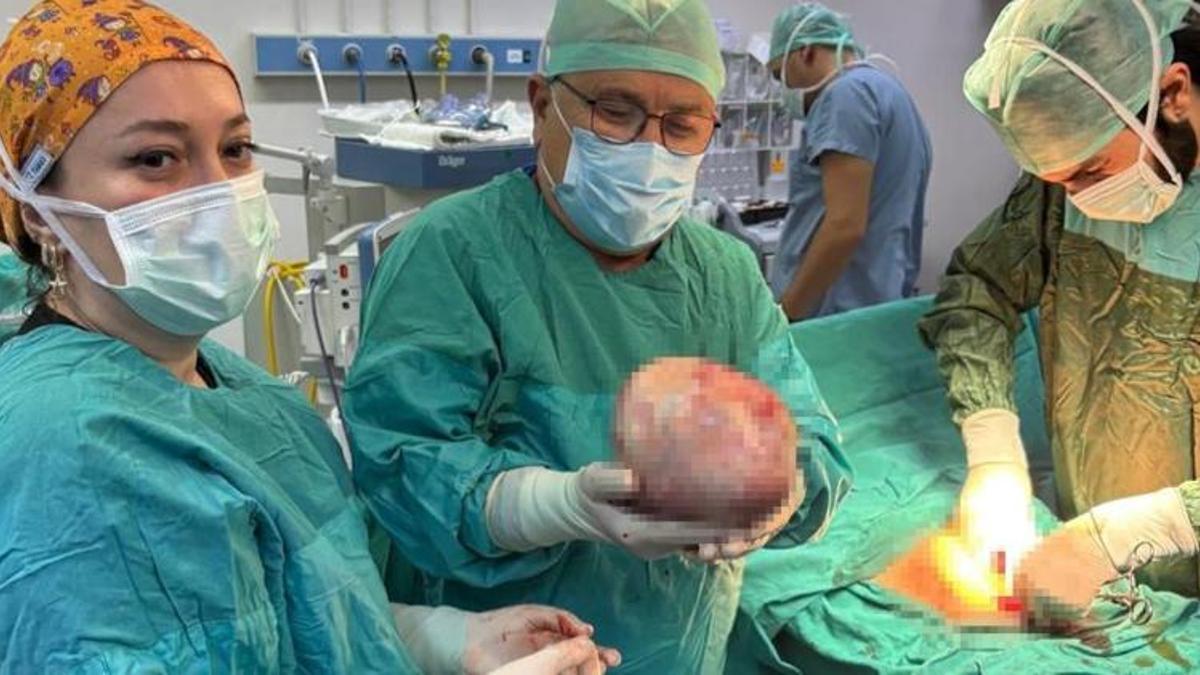 60 yaşındaki kadın 'hamileyim' sandı! Hastanede doktorlar inanamadı, tam 6 kilo çıktı