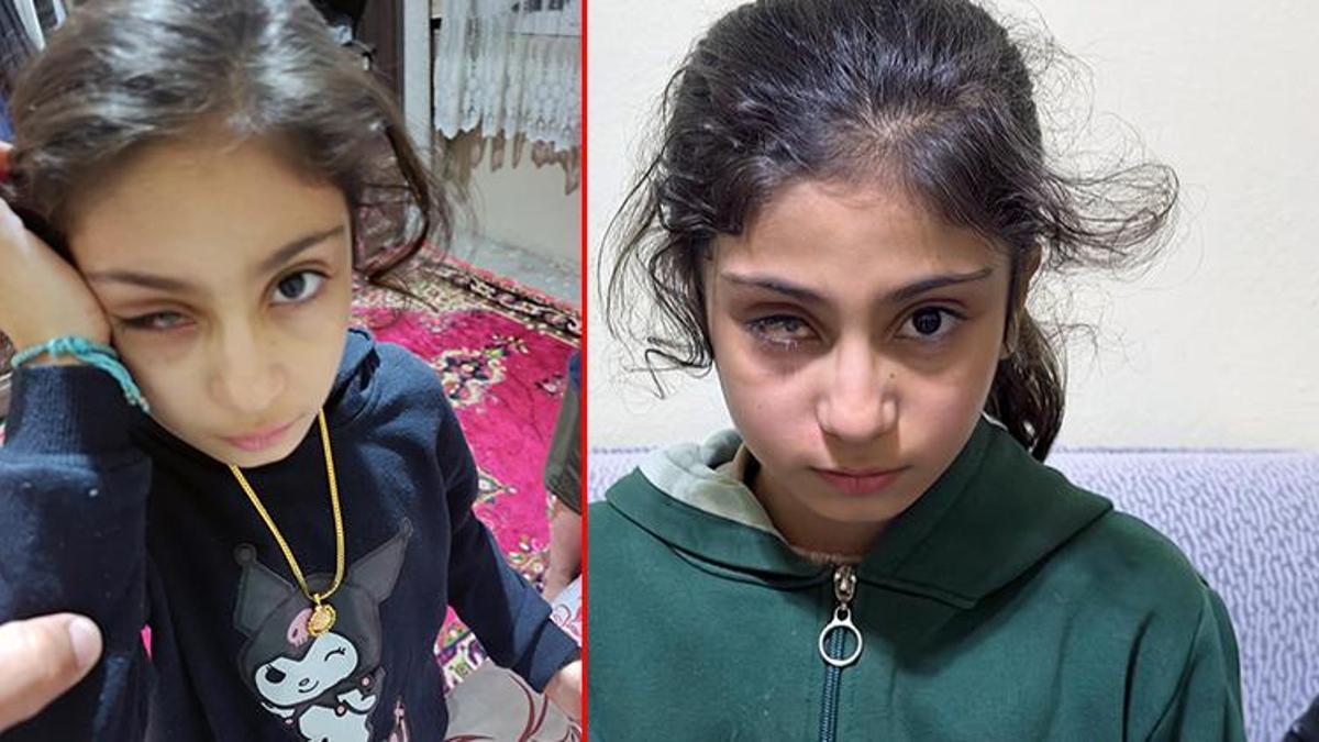 Plastik diye sattıkları gözlük cam çıktı! Şeyma bir gözünü kaybetti