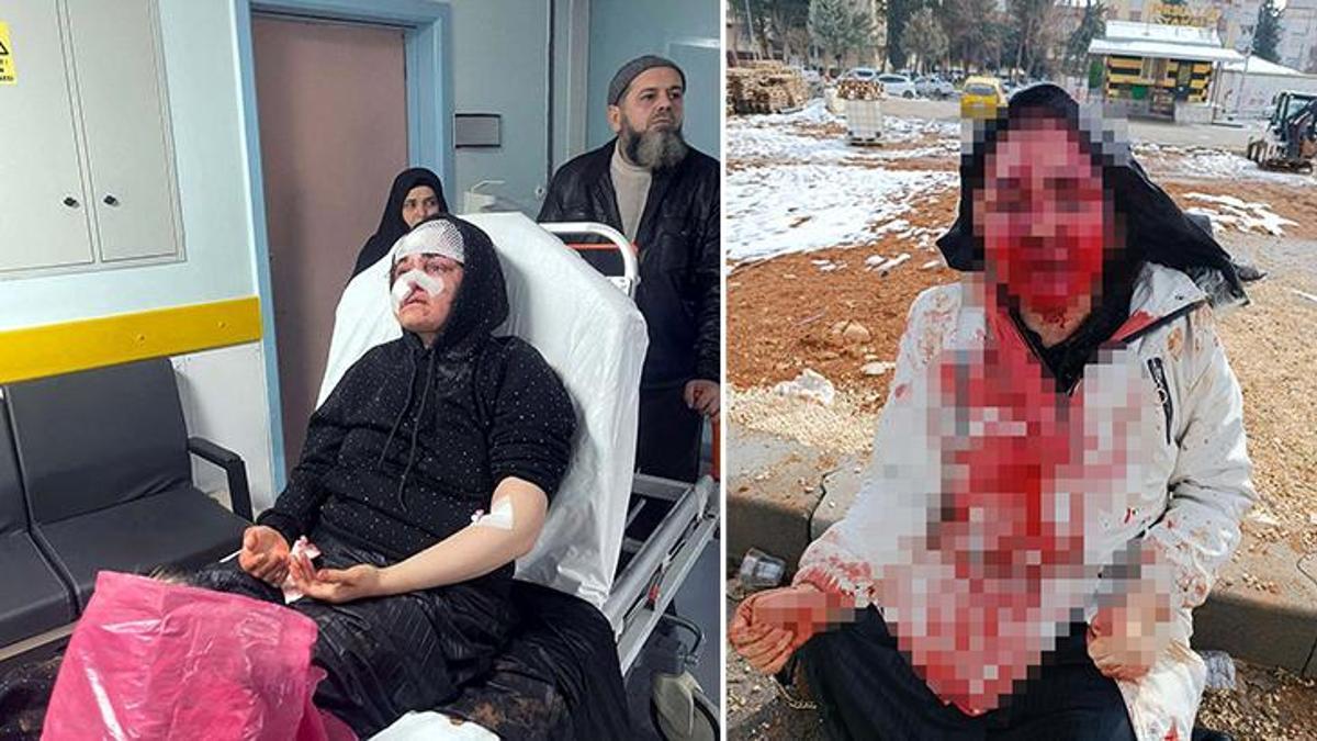 Gaziantep'te korkunç olay! Boşanma aşamasındaki eşine kaldırım taşıyla işkence etti