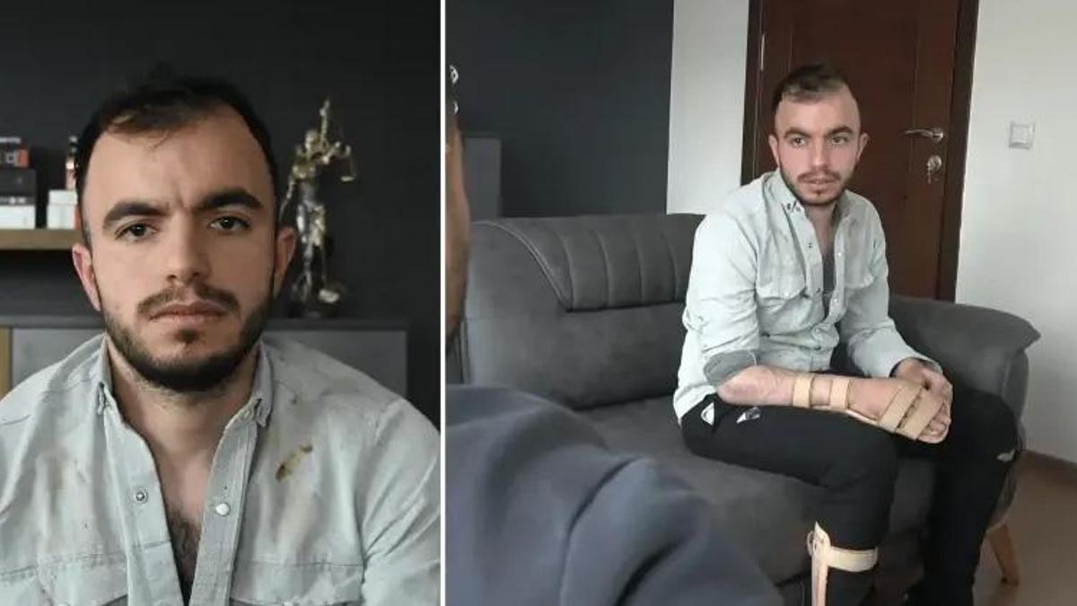 Konya- Başına metal parça saplanan işçi, 17,9 milyon TL tazminat kazandı