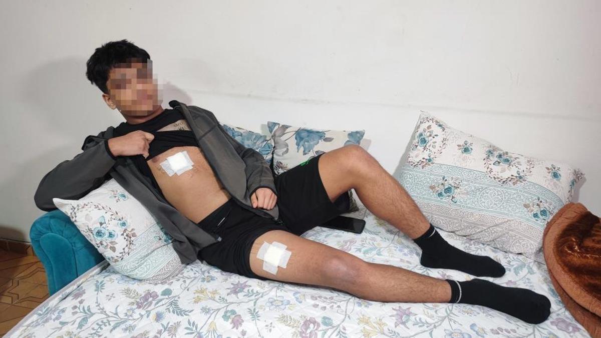 Akran zorbalığı az kalsın öldürüyordu! Önce dövüldü sonra bıçaklandı