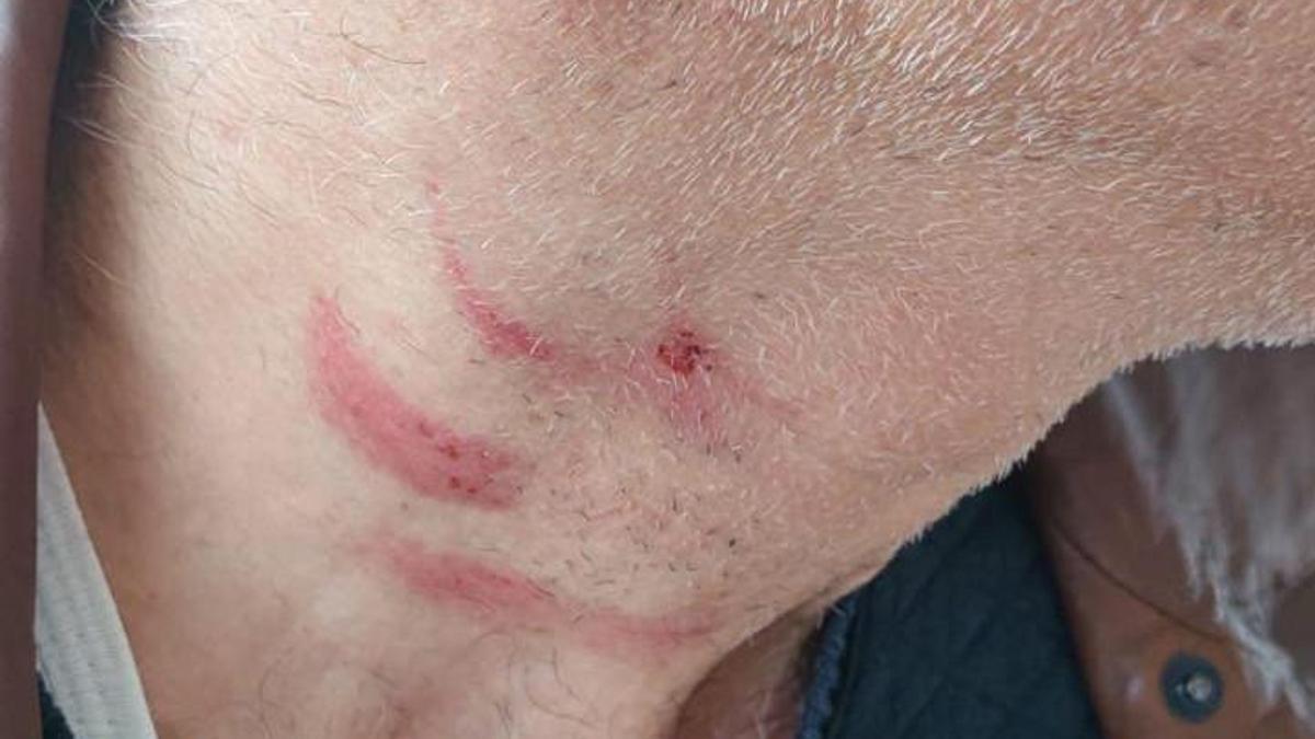 Aile hekimini darbeden müezzin, savcılığın itirazıyla yeniden gözaltına alınıp tutuklandı