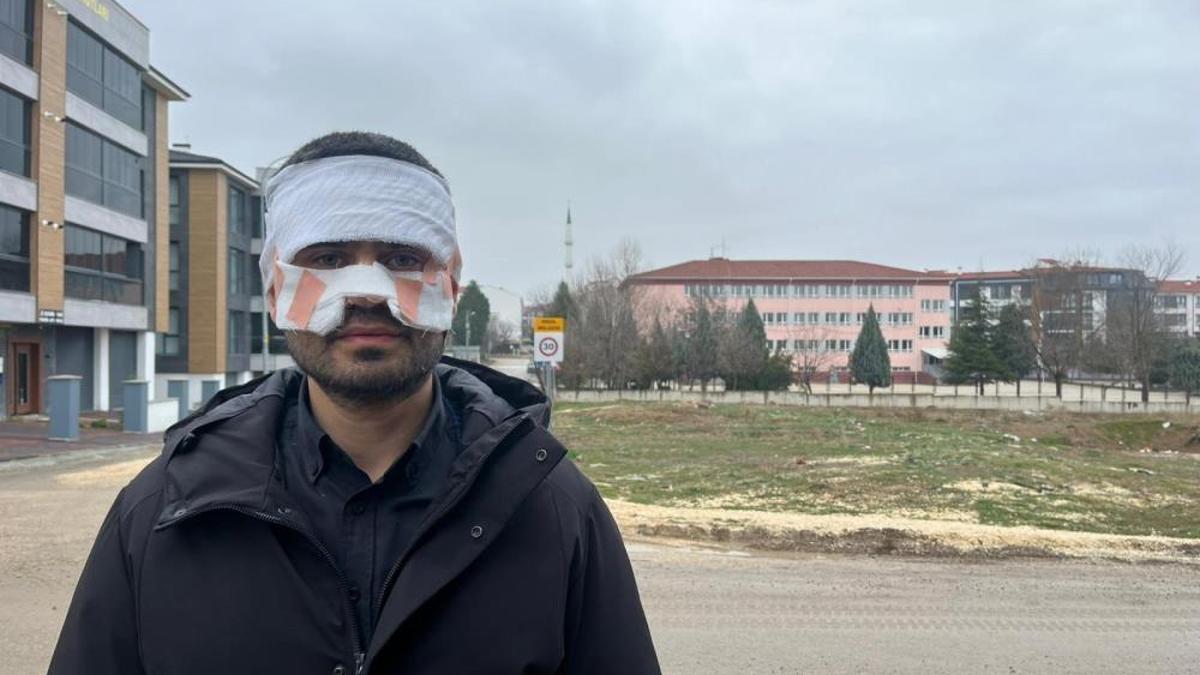 Eskişehir'de okulda dehşet! Öğretmen arkadaşını feci şekilde yaktı