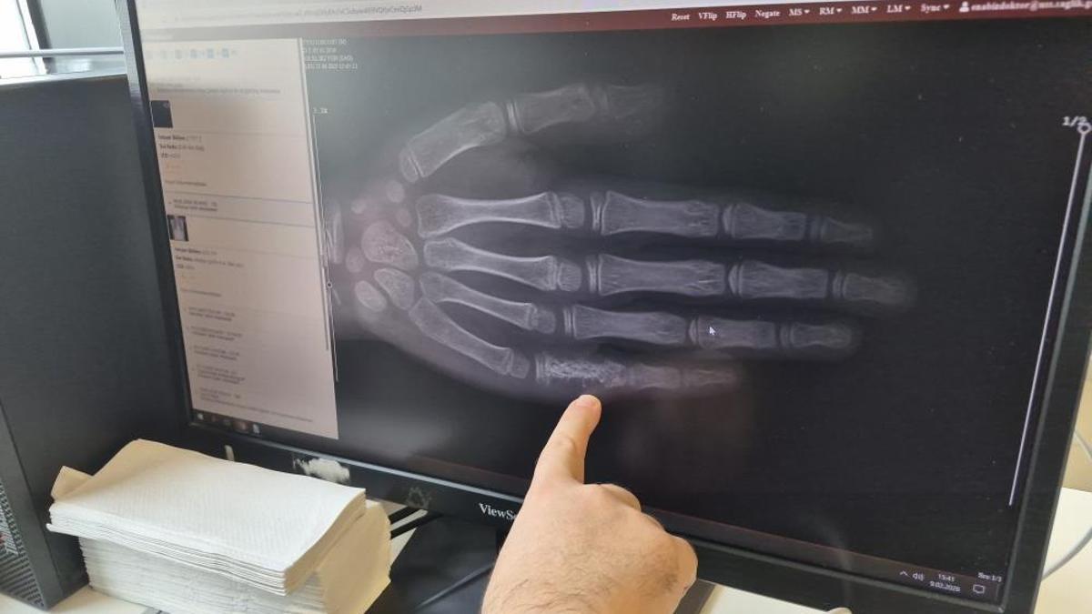Eskişehir'de her ay 5 ila 7 çocuğun başına geliyor! Aileler buna dikkat