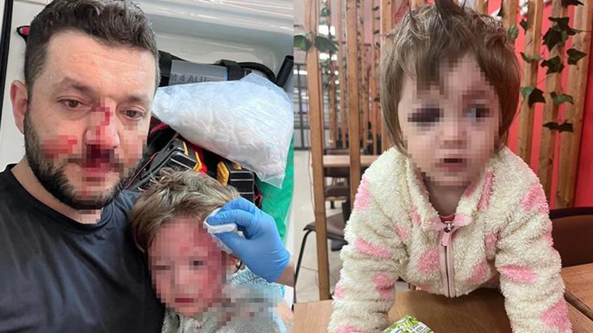 Gürültü tartışmasında komşusu dehşet saçtı! 14 aylık bebeğe bile acımadı