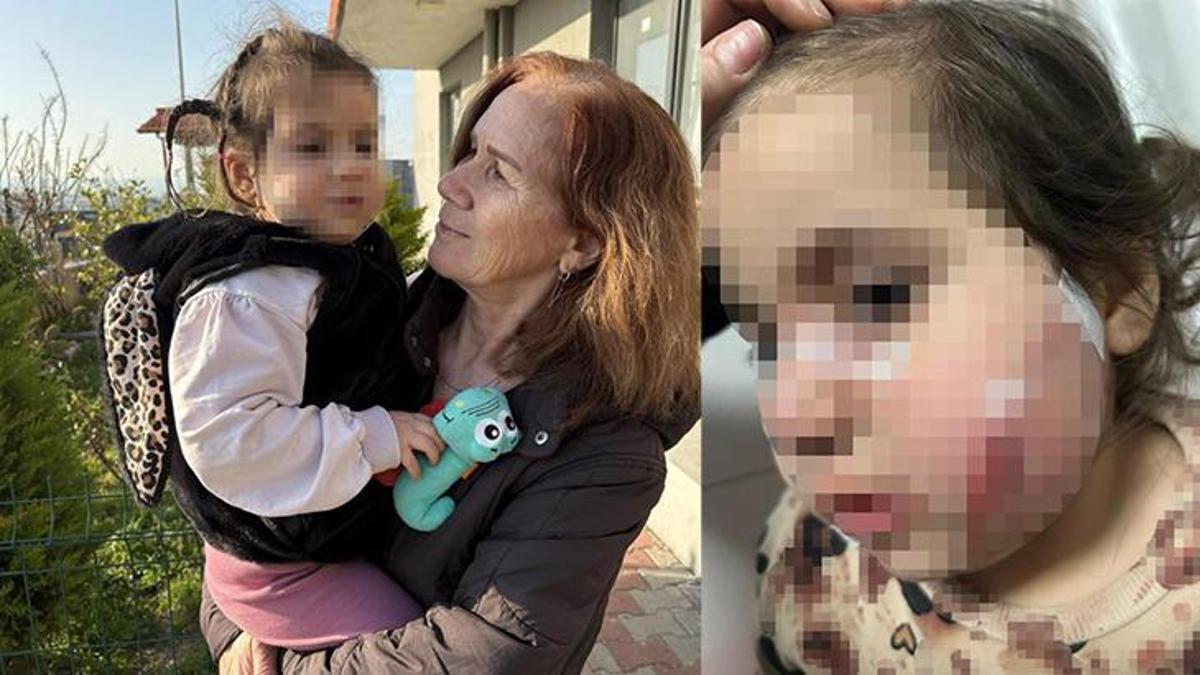İzmir'de köpek dehşeti! 3 yaşındaki çocuğun yüzü pençe ve ısırıkla dolu