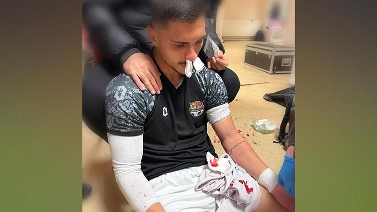 3. lig maçında ortalık karıştı! Futbolculara saldırdılar