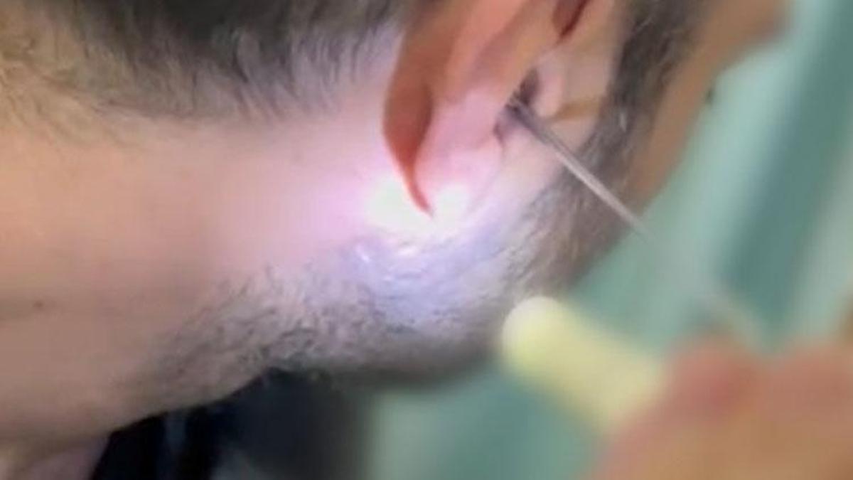 Kayseri’de bir kişi kulağına gizlediği uyuşturucuyla yakalandı