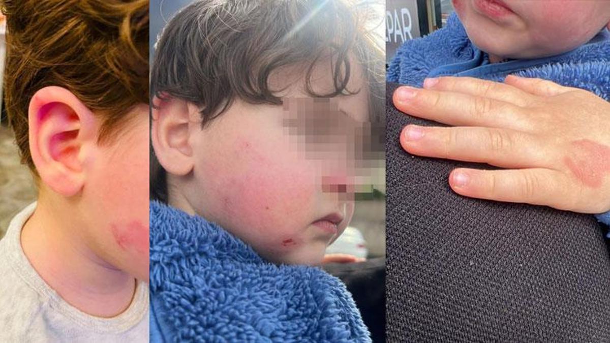 Gemlik'te kreşe bıraktığı çocuğunu darp edilmiş halde aldı