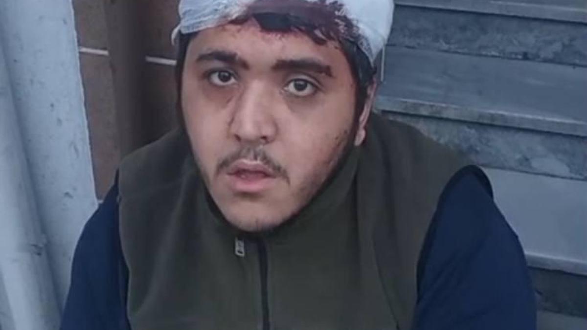 Sultangazi'de zihinsel engelli ve annesine sopalı saldırı