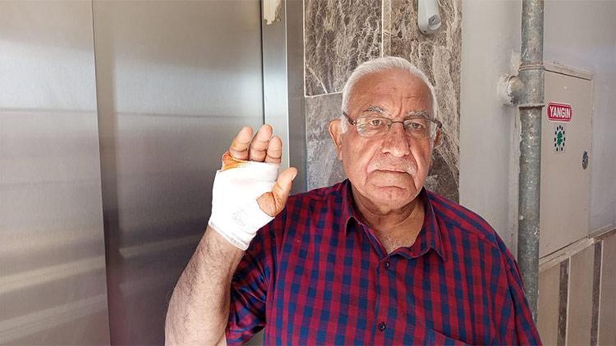 Hatay'da akılalmaz olay! Asansörde 70 yaşındaki komşusunun parmağını ısırarak kopardı