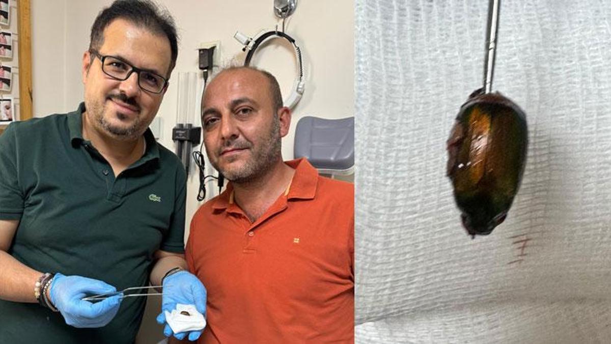 Alaşehir'de ağrı ve işitme kaybı nedeniyle hastaneye gitti, kulağından Japon böceği çıktı