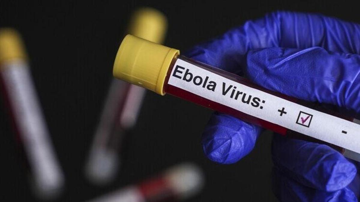 Fransa'da ilk vaka tespit edildi! Doktorun Ebola testi pozitif çıktı