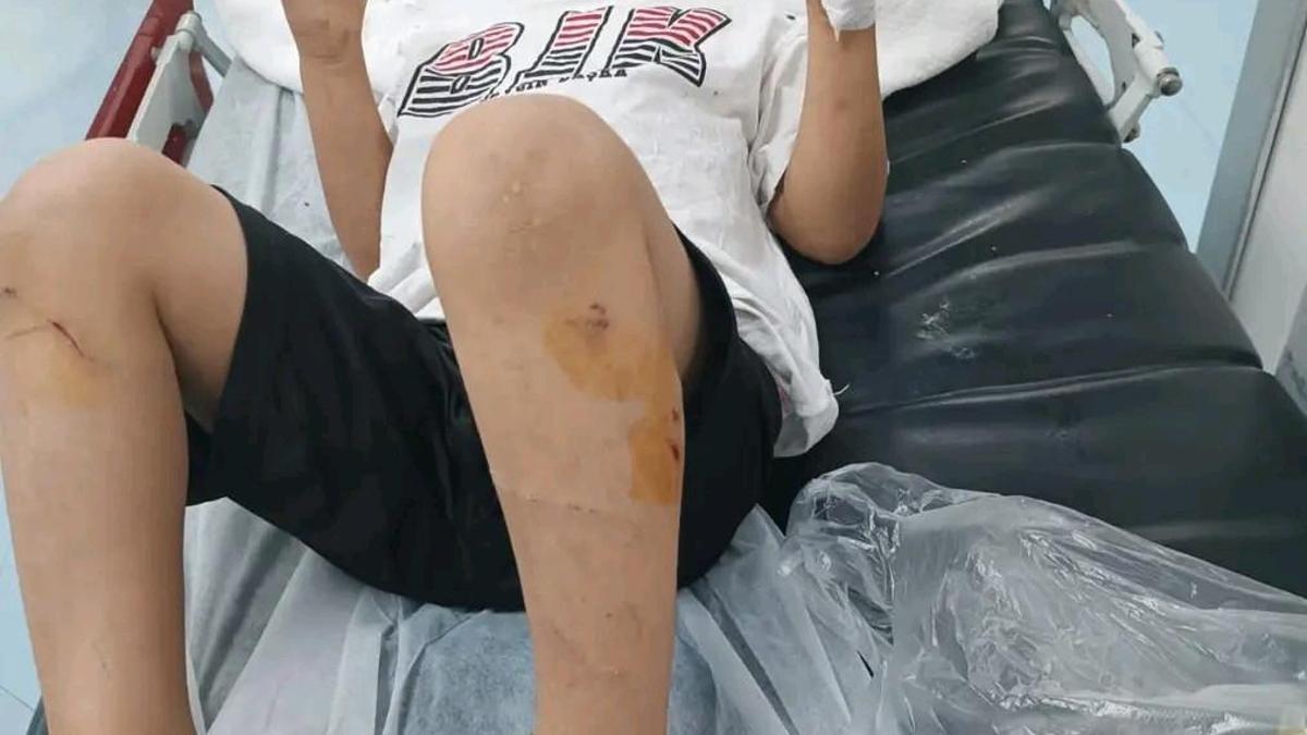 Sokak köpeklerinin saldırısına uğrayan Abdulkadir, yaralandı