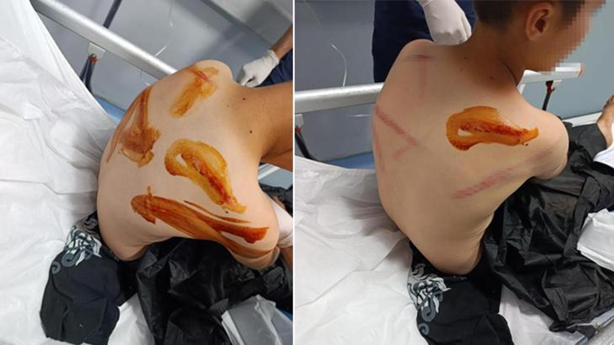 Şanlıurfa'da akran zorbalığı! 11 yaşındaki çocuğa öldüresiye dayak