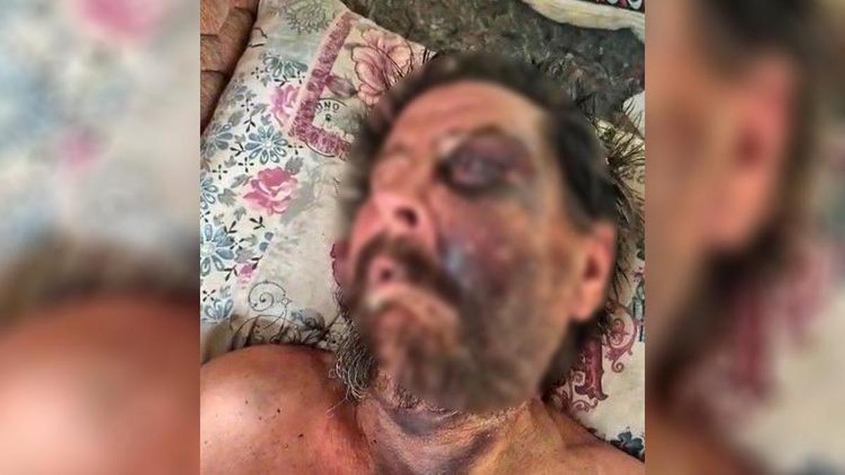 İzmir'de akıl almaz vahşet! 'Abimin cenazesine neden gelmedin?' diyerek öldüresiye dövdü, sonra ölüme terk etti!