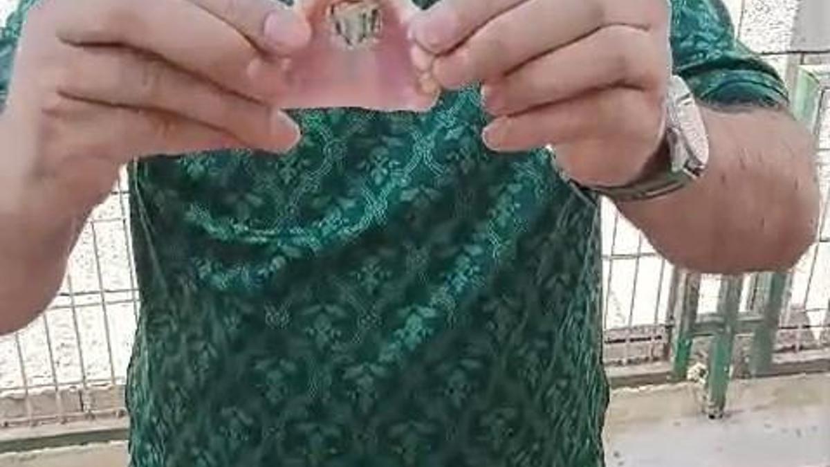 Bursaspor’un fanatik taraftarı takma dişinin damağına da kulüp amblemi yaptırdı