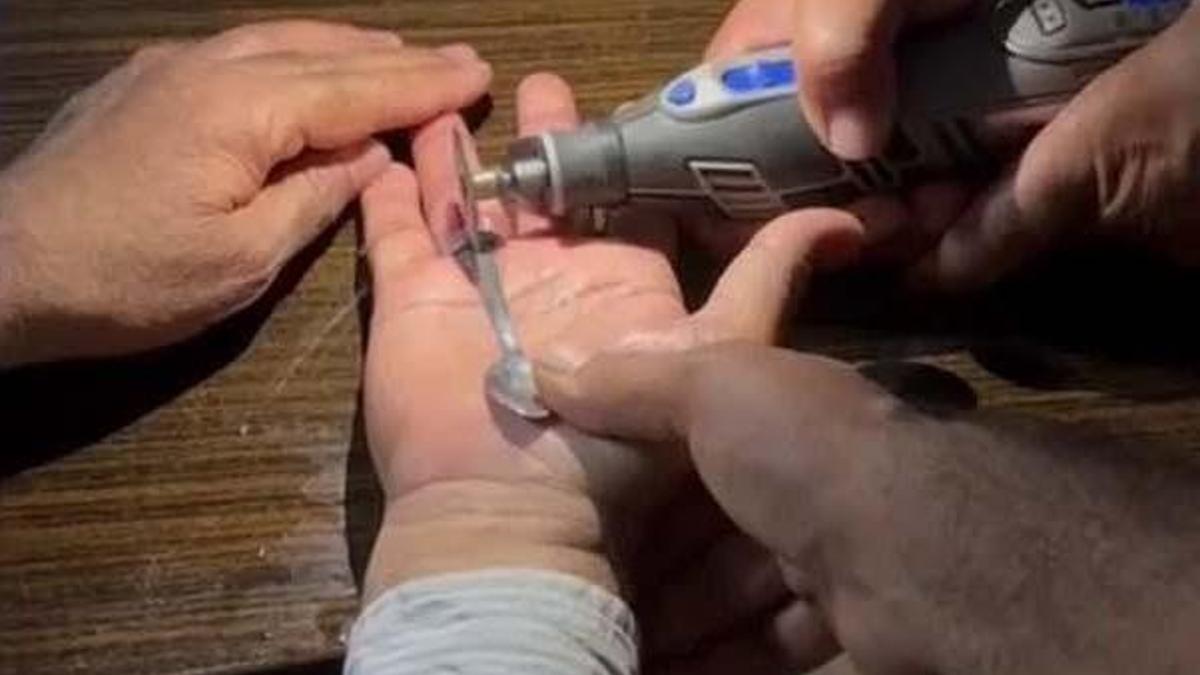 Parmaklarına sıkışan yüzükleri itfaiye çıkardı