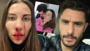 Özer Hurmacı'ya 3 yıl 6 ay, Mihriban Hurmacı'ya 5 yıl 6 aya kadar hapis talebi!