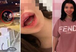 Genç kadını sokak ortasında darp etmişlerdi... Üç zorbaya 6 ay uzaklaştırma