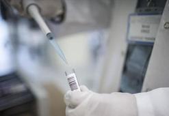 Corona virüste kullanılan immün plazma yöntemi nedir? İşte umut veren immün plazma tedavisi