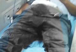 "İşe yaramıyor" deyip penisini kesti