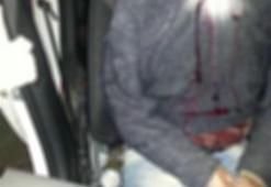 Hırsızlıktan aranan zanlının trafik kazasında başı koptu!