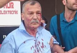 İki bombalı saldırıdan da sağ kurtuldu