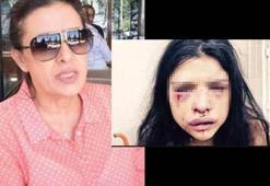 Melis Çakır’ın annesi: Onur kızımı öldürecek